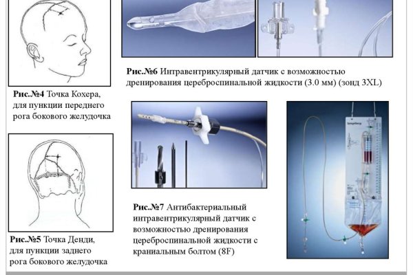 Взломали аккаунт на кракене что делать